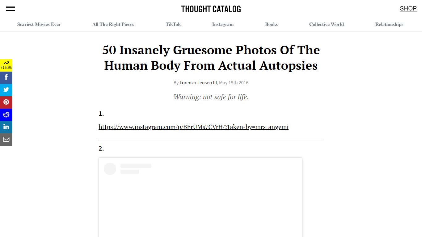 50 Insanely Gruesome Photos Of The Human Body From Actual Autopsies